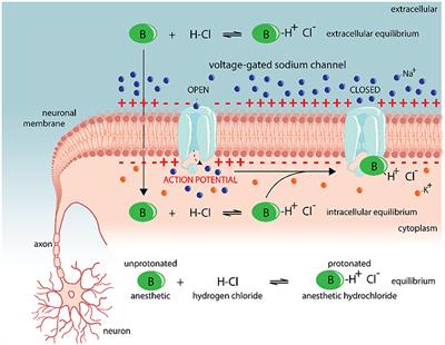 A novel tDCS control condition using optimized anesthetic gel to block peripheral nerve input